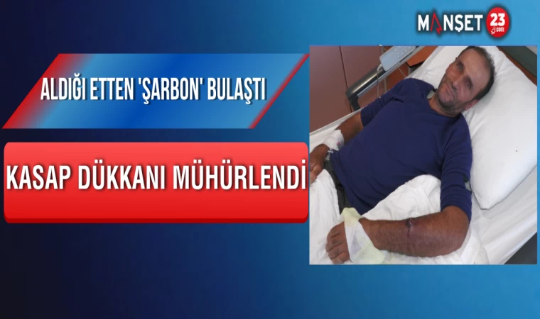 Aldığı Etten 'Şarbon' Bulaştı, Kasap Dükkanı Mühürlendi