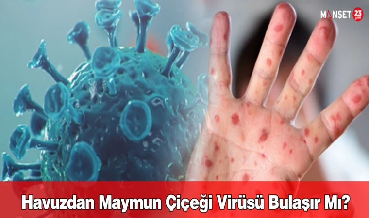 Havuzdan maymun çiçeği virüsü bulaşır mı?